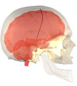 Deep Brain Stimulation in SOFA