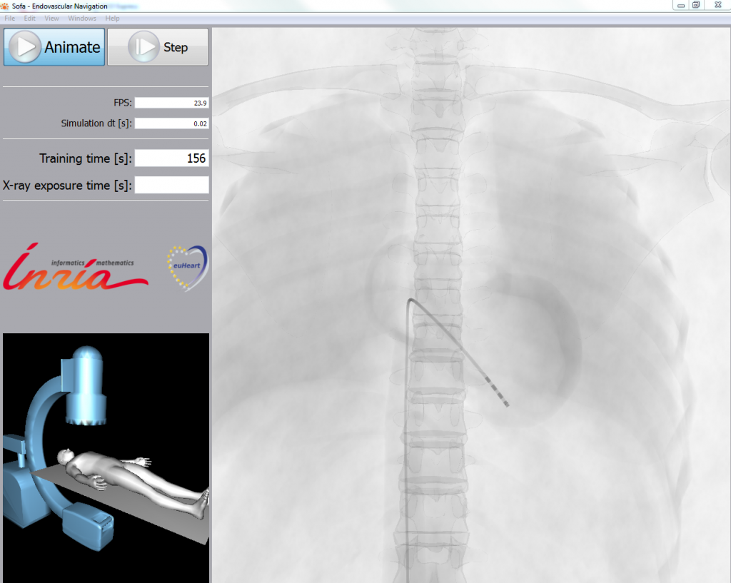 View 1 of the simulation