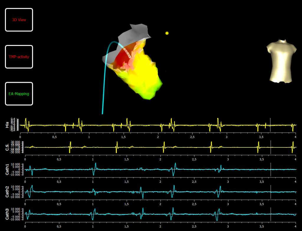 View 2 of the simulation